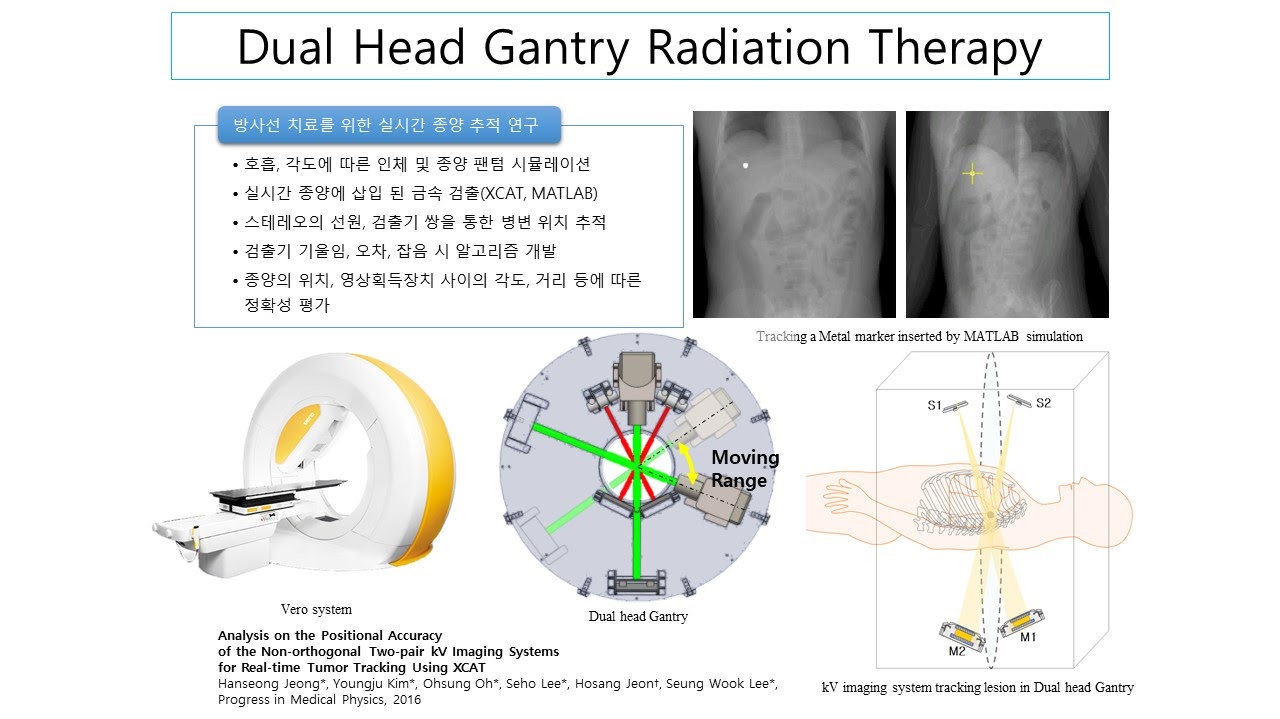 Radiation Therapy Research